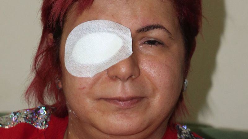 Samsun'da kendisine verilen serum, alerji yaptı