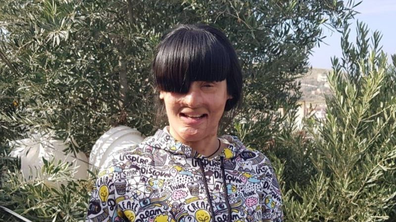 Hatay'da yüzüne asit atıldı: Cezalar artarsa, suça meyil azalır