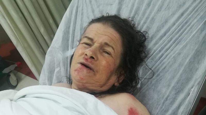 İzmir'de sele kapılan kadının tedavisi sürüyor