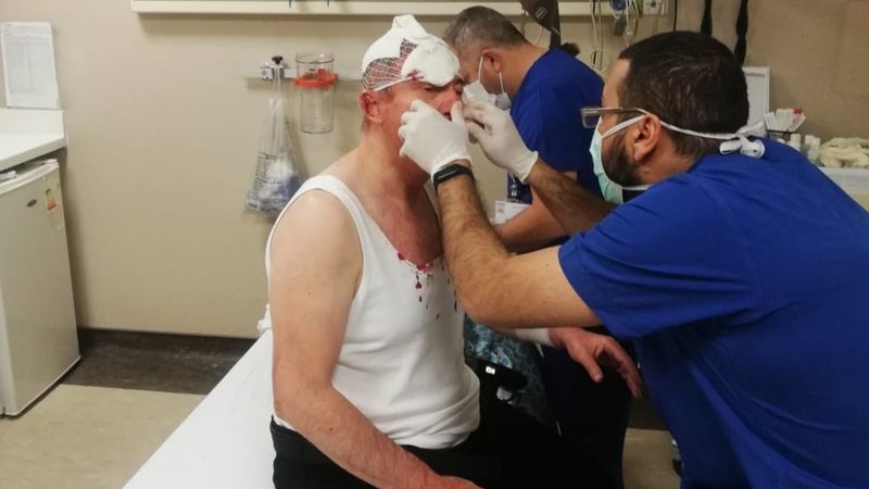 Gelecek Partisi Genel Başkan Yardımcısı Selçuk Özdağ'a saldırı