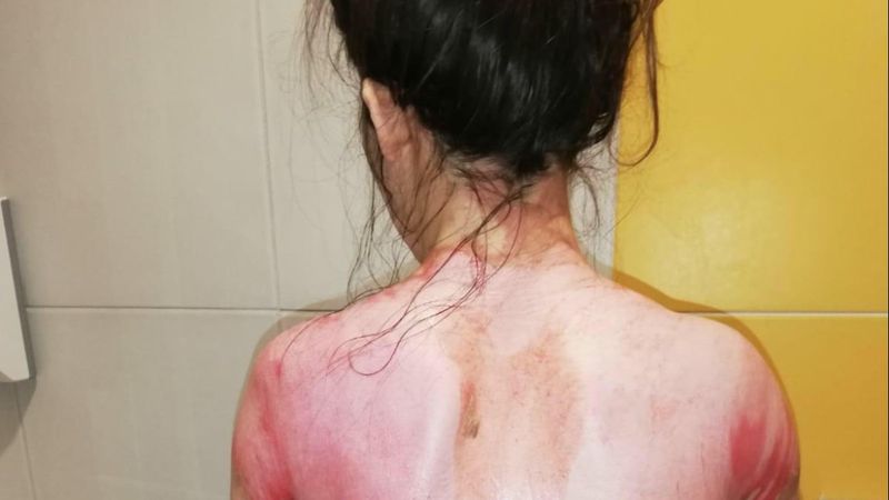 Konya'da eşini kaynar suyla yakan koca serbest kaldı