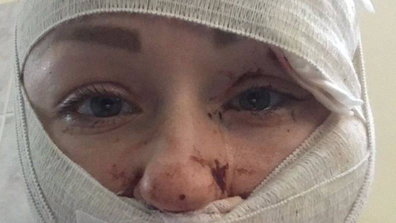 Boşanmak isteyen Ukraynalı kadın, Bakırköy'de saldırıya uğradı