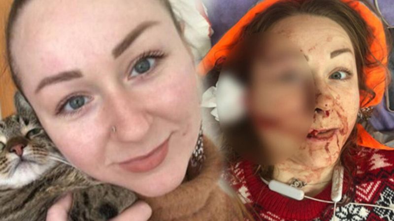 İstanbul'da eşinin falçatayla saldırdığı Hanna, yardım bekliyor