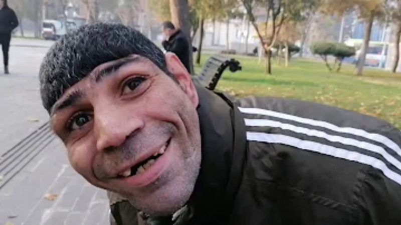 Mikrosefali hastalığı nedir? Mikrosefali hastalığı belirtileri nelerdir? Mikrosefali nedenleri ve tedavisi..