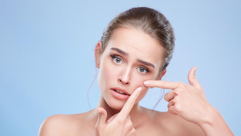 Siyah noktalara neden olabilecek 7 faktör