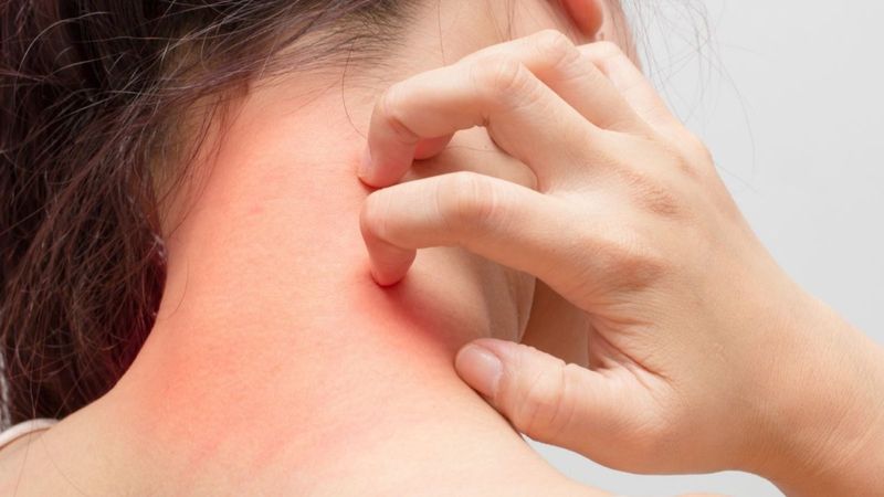 Kuru ve kaşıntılı cilt için tedavi yöntemleri