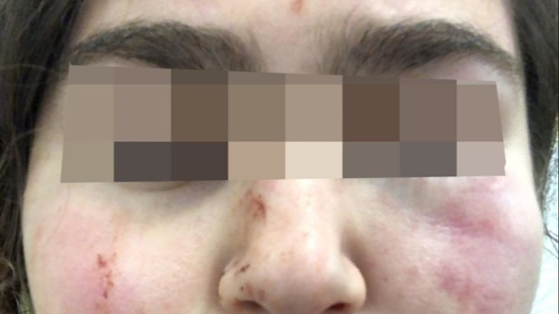 Alman polisinden Türk baba ile kızına şiddet