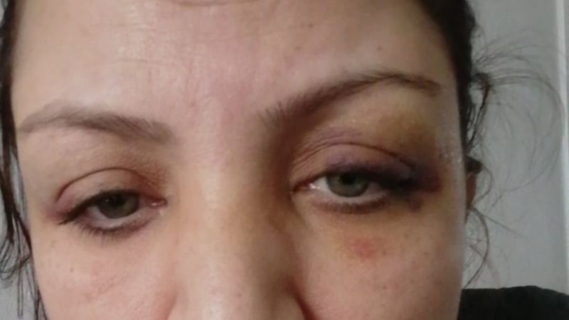 İzmir'de kirayı geciktiren kadına darp