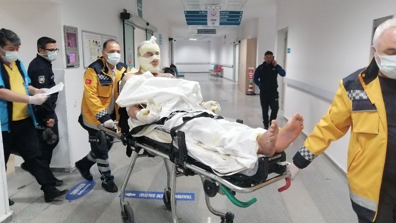 Aksaray'da intihar etmek isteyen kişi hem kendini hem oteli yaktı