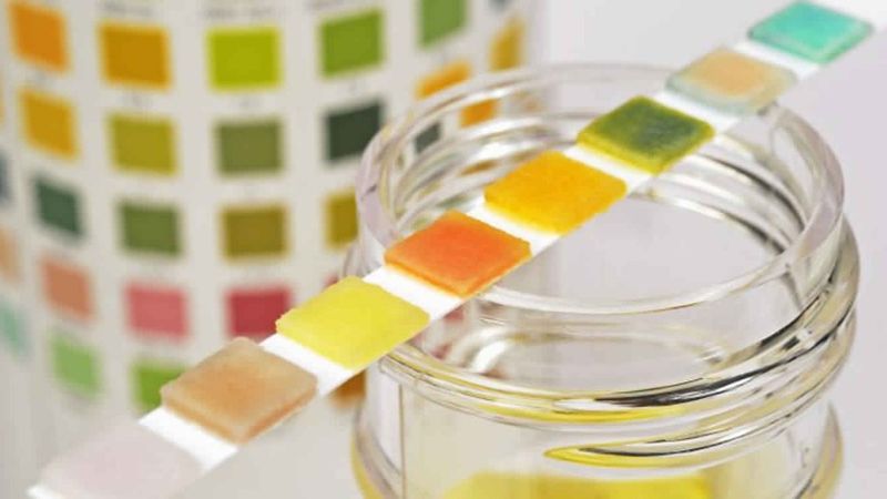 İdrar rengi sağlığınız hakkında ne diyor