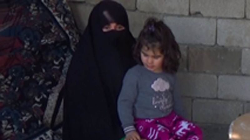 Iğdır'da bacakları yanan  Fatmanur, ayakkabı giyip, koşmak istiyor