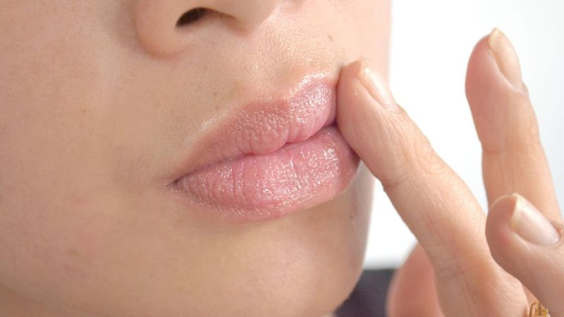 Çatlak dudaklar ve kuru ciltler için ipuçları
