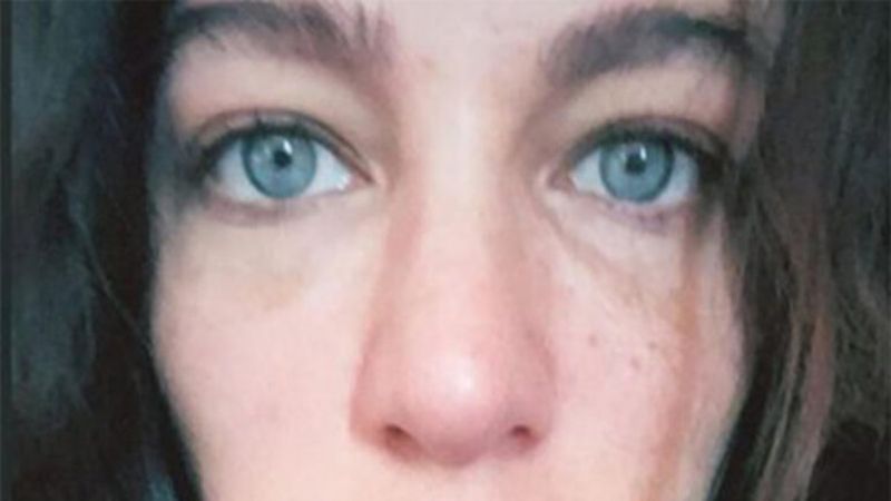 Makyajsız Berrak Tüzünataç