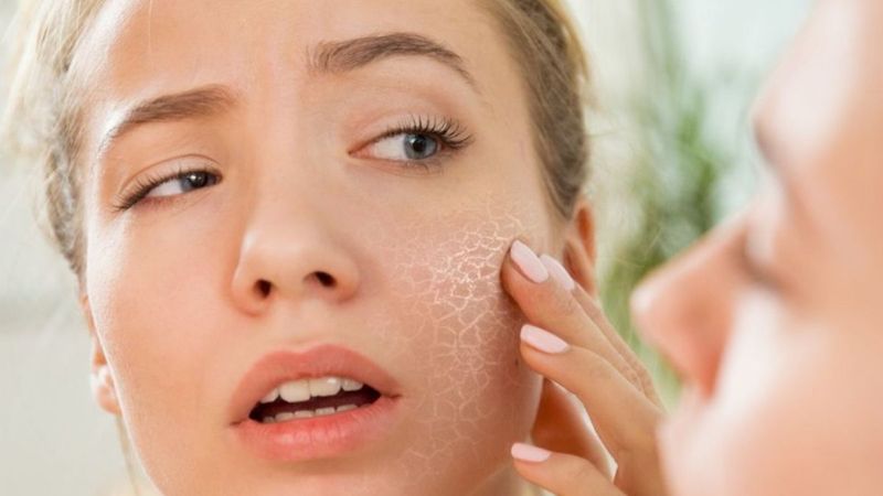 Soğuk havalarda cildinizin bariyerini koruyun