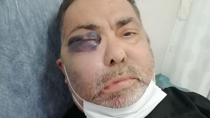 Antalya'da engelli kişiyi darbeden şahıs tutuklandı