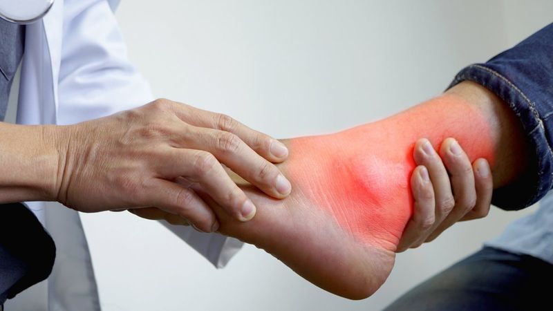 Gut hastalığı iyi bir tedaviyle önlenebilir