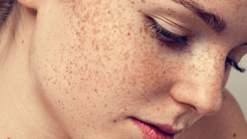 Cildinizi güneş hasarından koruyan 5 besin