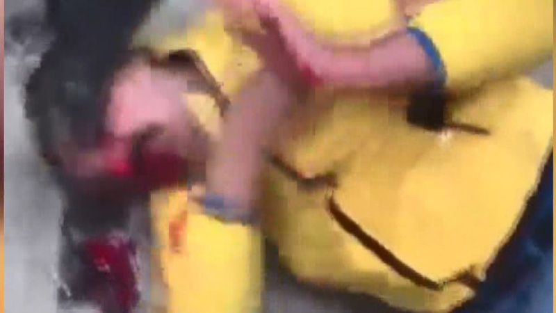 Fatih'te silahla yaralanmasına rağmen saldırganı kovaladı