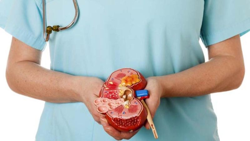 Böbrek taşlarını önlemek için beslenme ipuçları