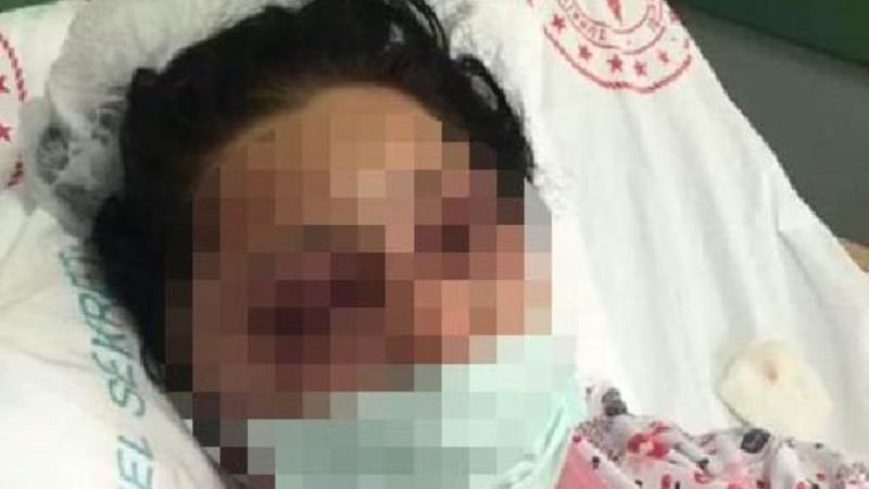 Samsun'da eski eşi tarafından darbedilen Emriye konuştu