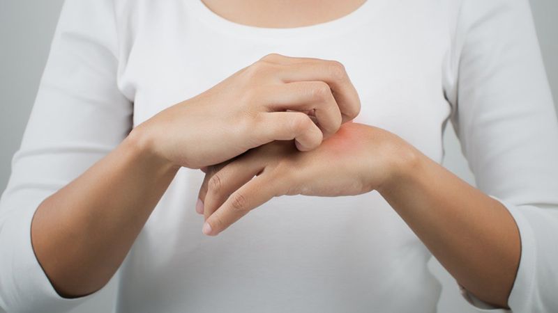 Soğuk kış günleri deri hastalıklarına sebep olabilir