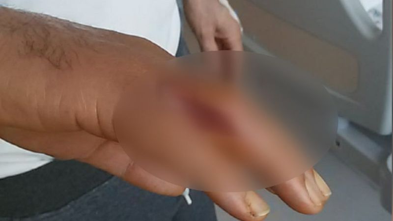 Nişantaşı'nda garsonun eline batan kürdan kabusu oldu