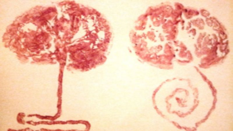 Bebeğinizden bir hatıra: Plasenta baskısı nedir?