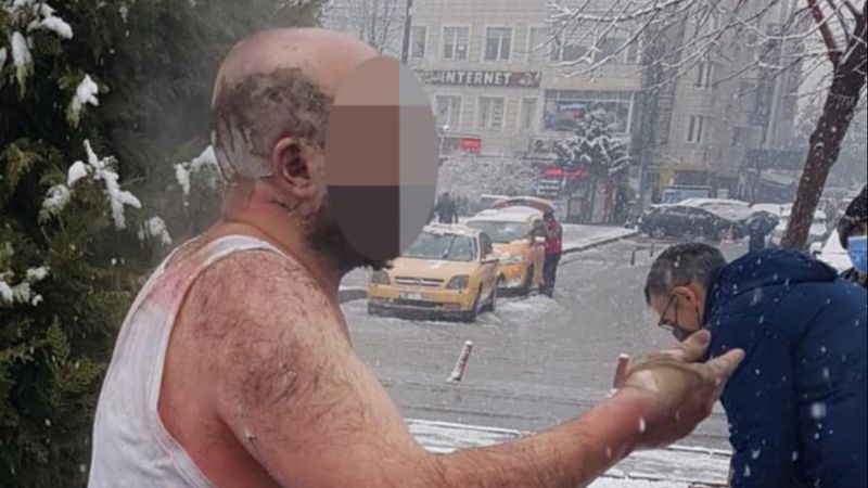 Kayseri'de ailesiyle tartışıp kendini yaktı