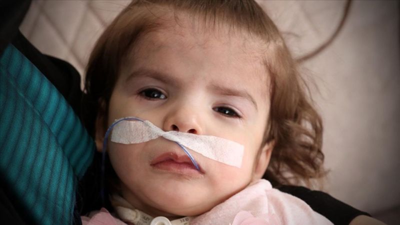 Sivaslı anne, kızının kas hastalığına çare arıyor