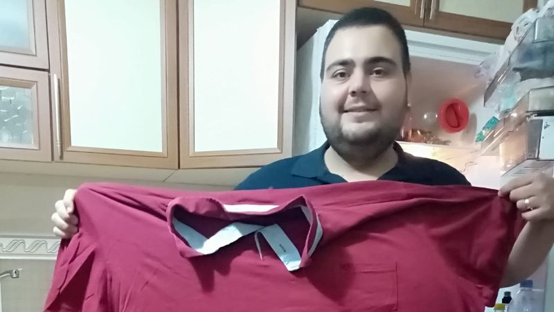 Ankaralı esnaf, mide küçültme ameliyatı ile 129 kilo verdi