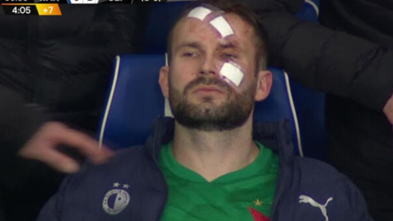 Slavia Prag kalecisi Kolar'ın son hali