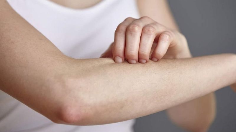 Deri döküntüleri, koronavirüs belirtisi olabilir