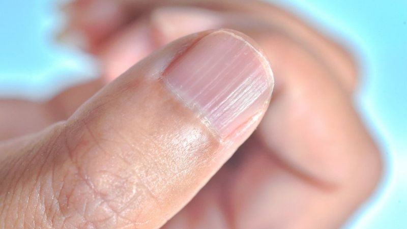 Besin eksikliklerinin 7 yaygın belirtisi