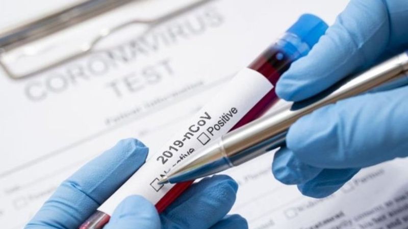 Eskişehir'de 90 kişinin korona testleri karıştı