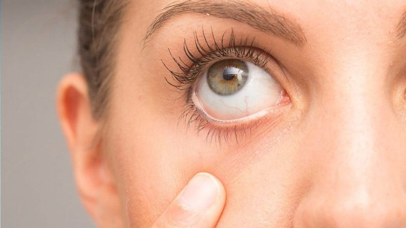 Göz doktoruna gitmenizi gerektiren 12 işaret