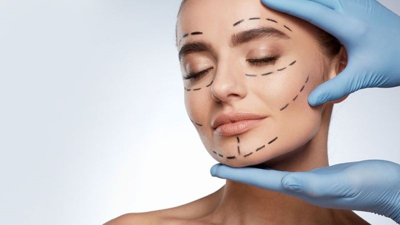 Ameliyatsız yüz germede endopeel yöntemi kullanılabilir