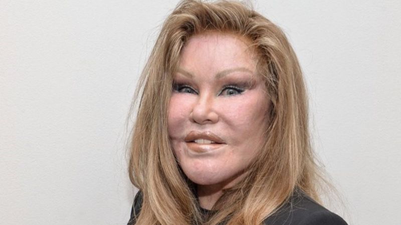 Jocelyn Wildenstei estetik masrafları yüzünden iflas etti