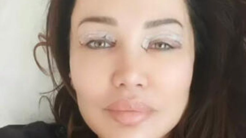 Umut Akyürek göz kapağı ameliyatı oldu