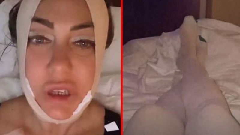 Yeliz Yeşilmen, estetik ameliyatı geçirdi
