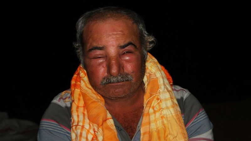 Antalya'da arı saldırısına uğrayan çoban: İnsanlar dışarı çıkamaz oldu