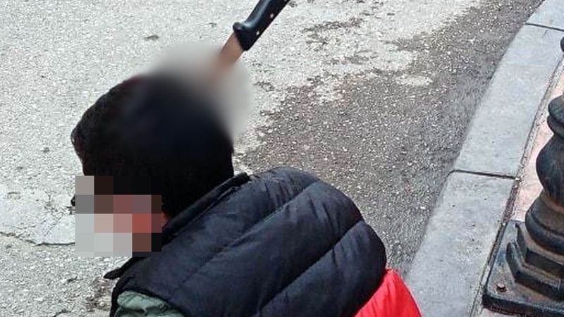 Samsun’da kafasına ekmek bıçağı saplandı, uyuşturucu ile yakalandı