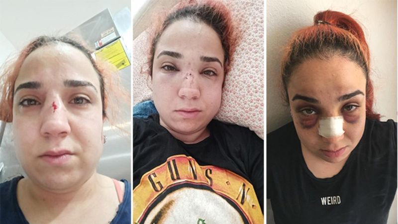 İzmir'de patronundan dayak yiyen kadın şikayetçi oldu