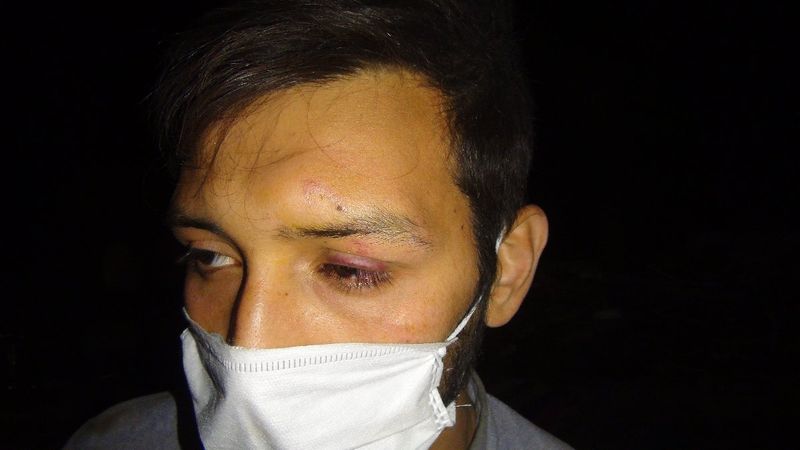 Şanlıurfa’da hırsızlar gece bekçisini hortumla döverek bayılttı