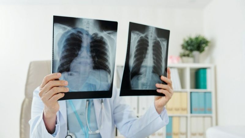Akciğerlerde sertleşme solunum yetmezliğine neden olabilir