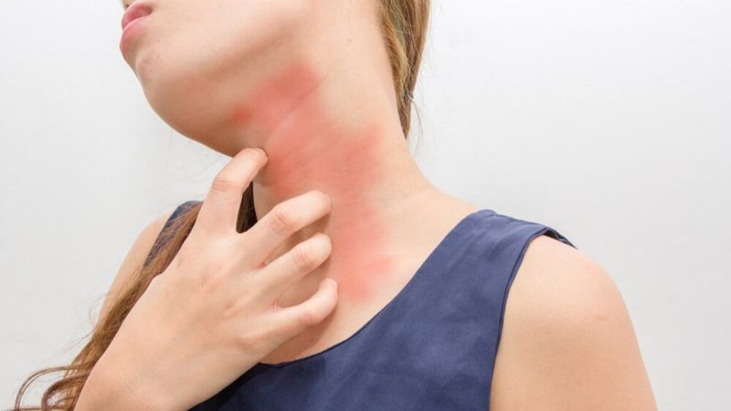 Baharda sık görülen 5 cilt hastalığı