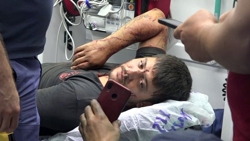 Antalya'da tüfekle yaralanan şahıs 1 kilometre yürüyerek yardım istedi