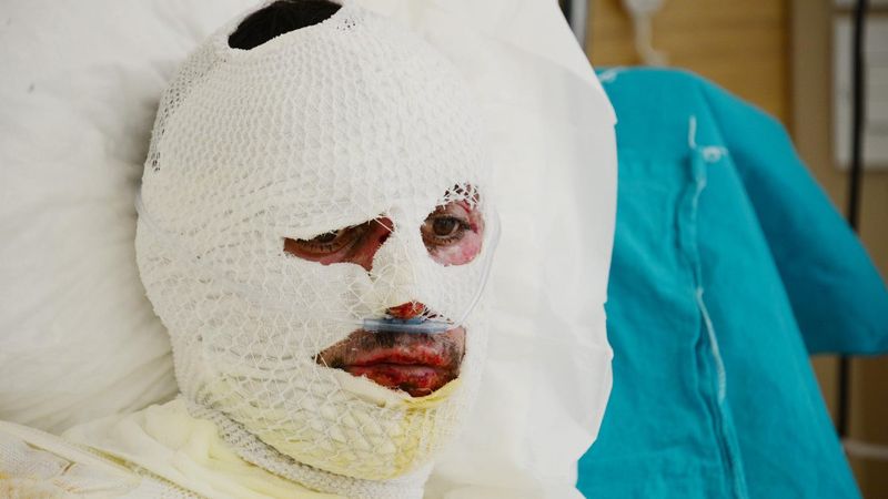 Erzurum'da üzerine yıldırım düşen çoban, tedaviye alındı