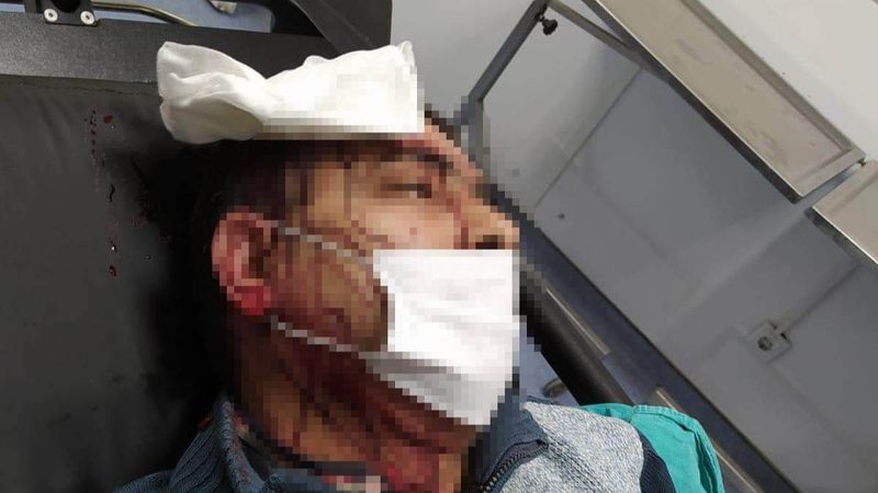 Amasya'da imam, kendisini uyaran müezzine saldırdı