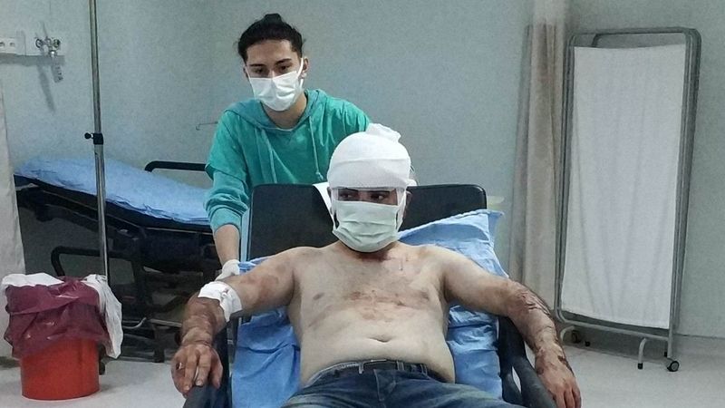 Samsun'da, yanına kaçan kadının ailesi tarafından darbedildi