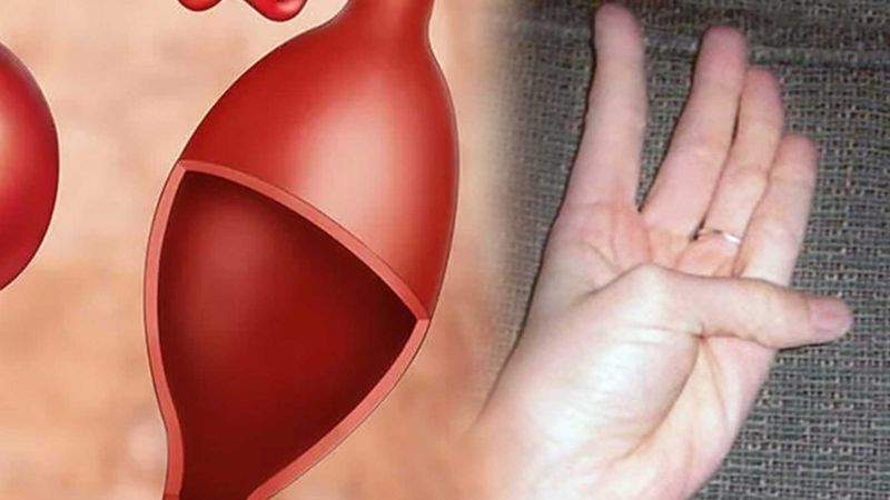 Eliniz, kalp hastalıklarını gösterebilir